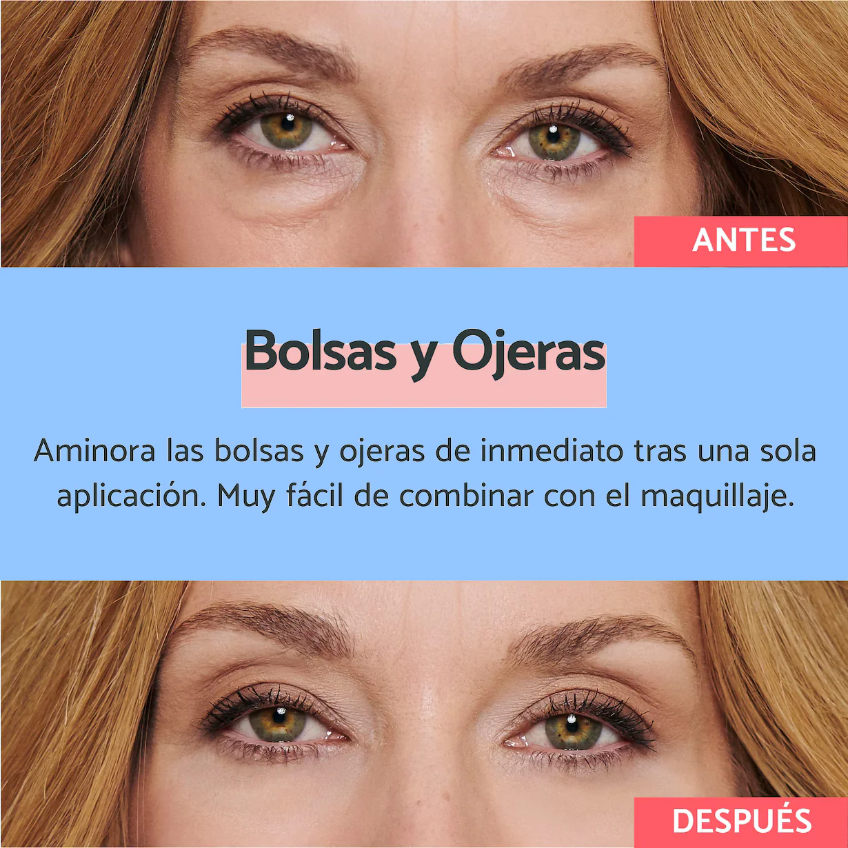 EYEPEP™ - DI ADIÓS A LAS OJERAS