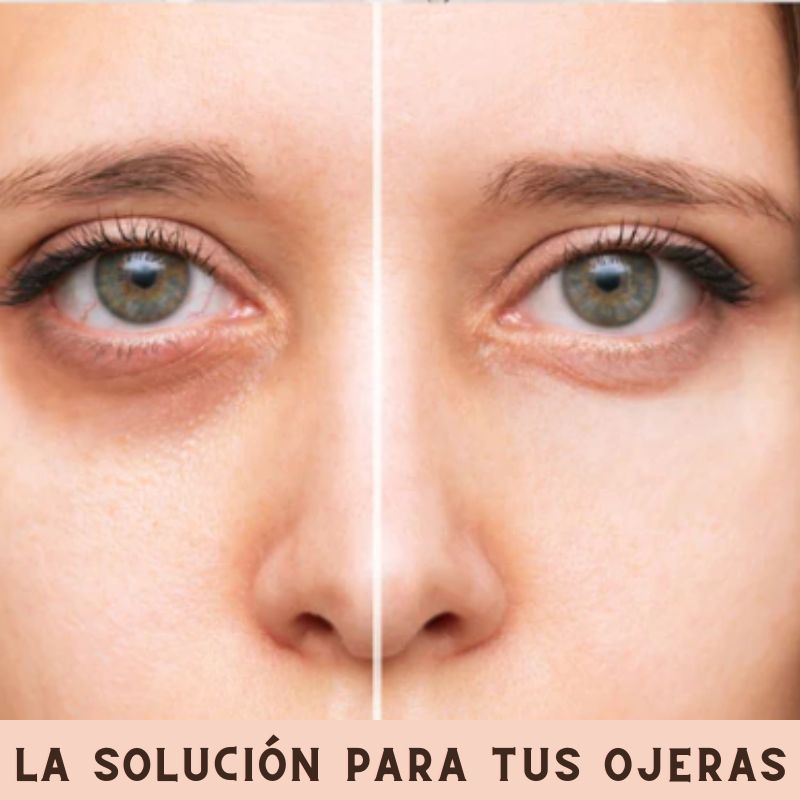 EYEPEP™ - DI ADIÓS A LAS OJERAS