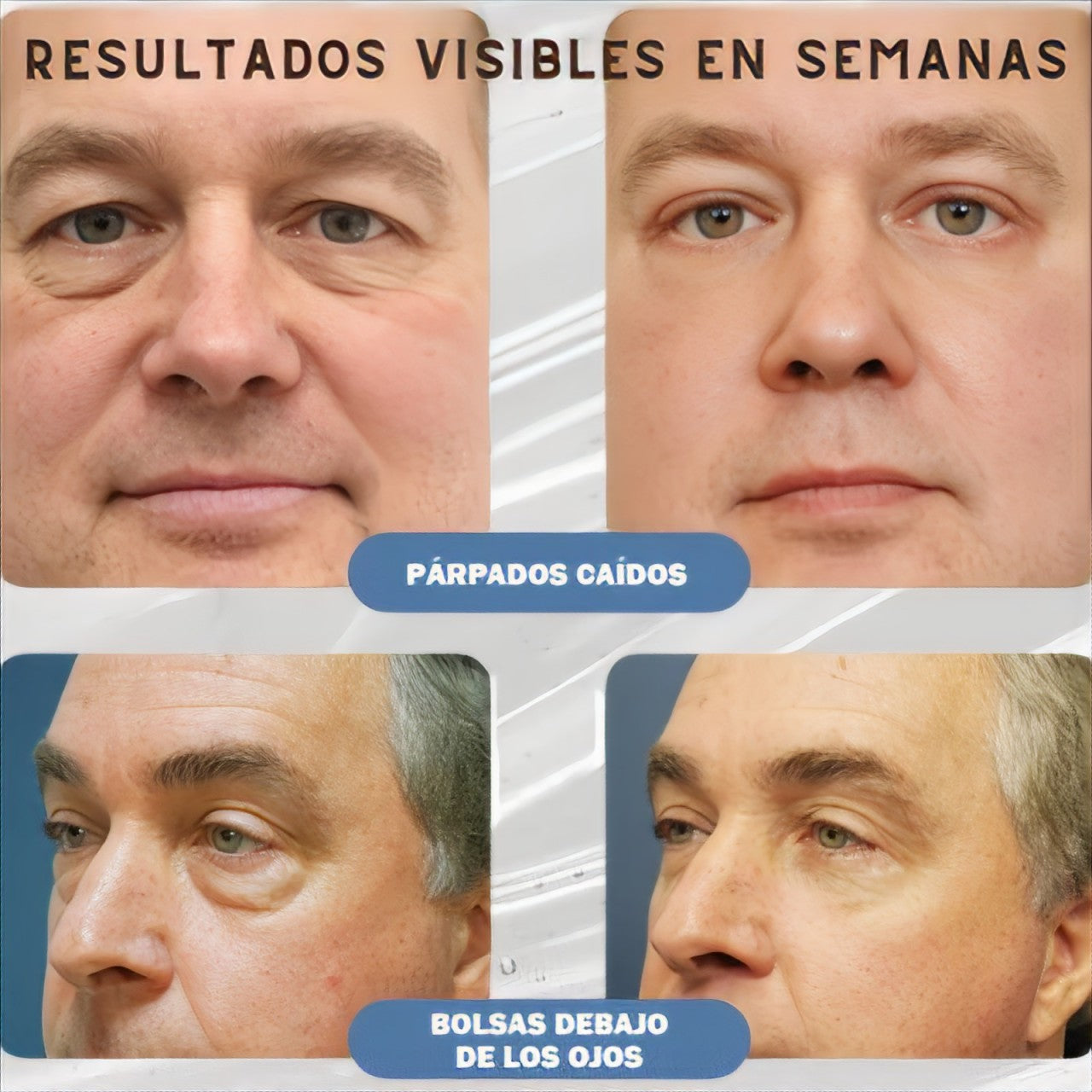 EYEPEP™ - DI ADIÓS A LAS OJERAS