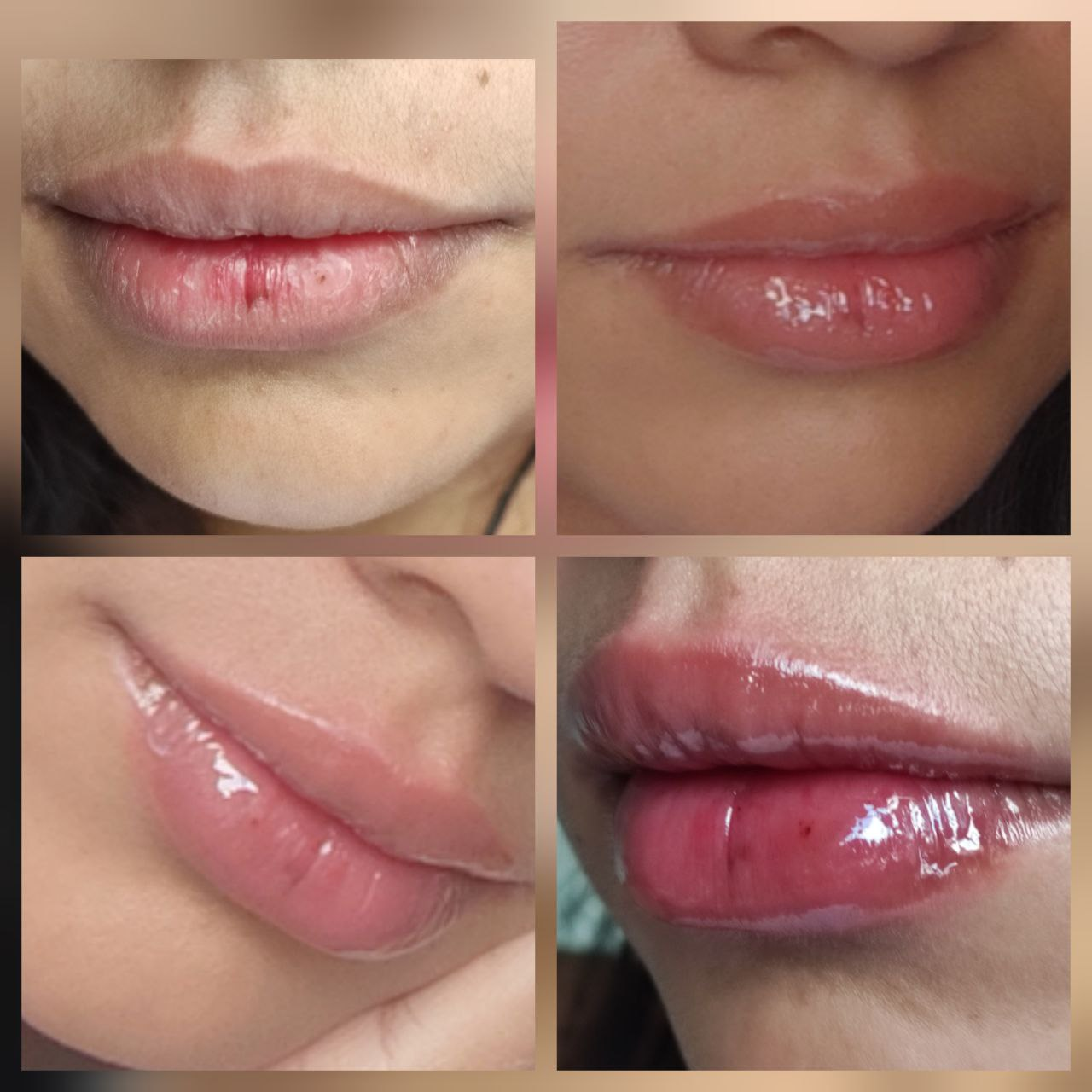 Lip Maximizer - Gloss Hidratante e Volumizador para os Lábios (2x1 OFERTA)